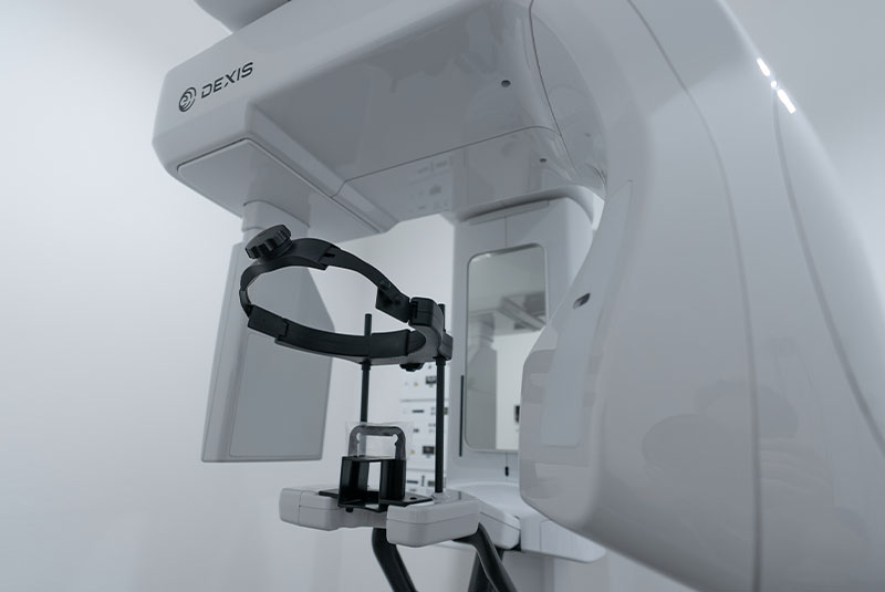 cbct machine