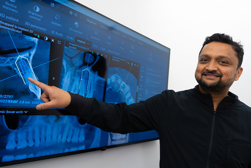 results for dental implants with tech